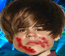 Hurt Ragdoll Bieber 2