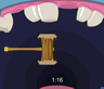 Teeth Smasher